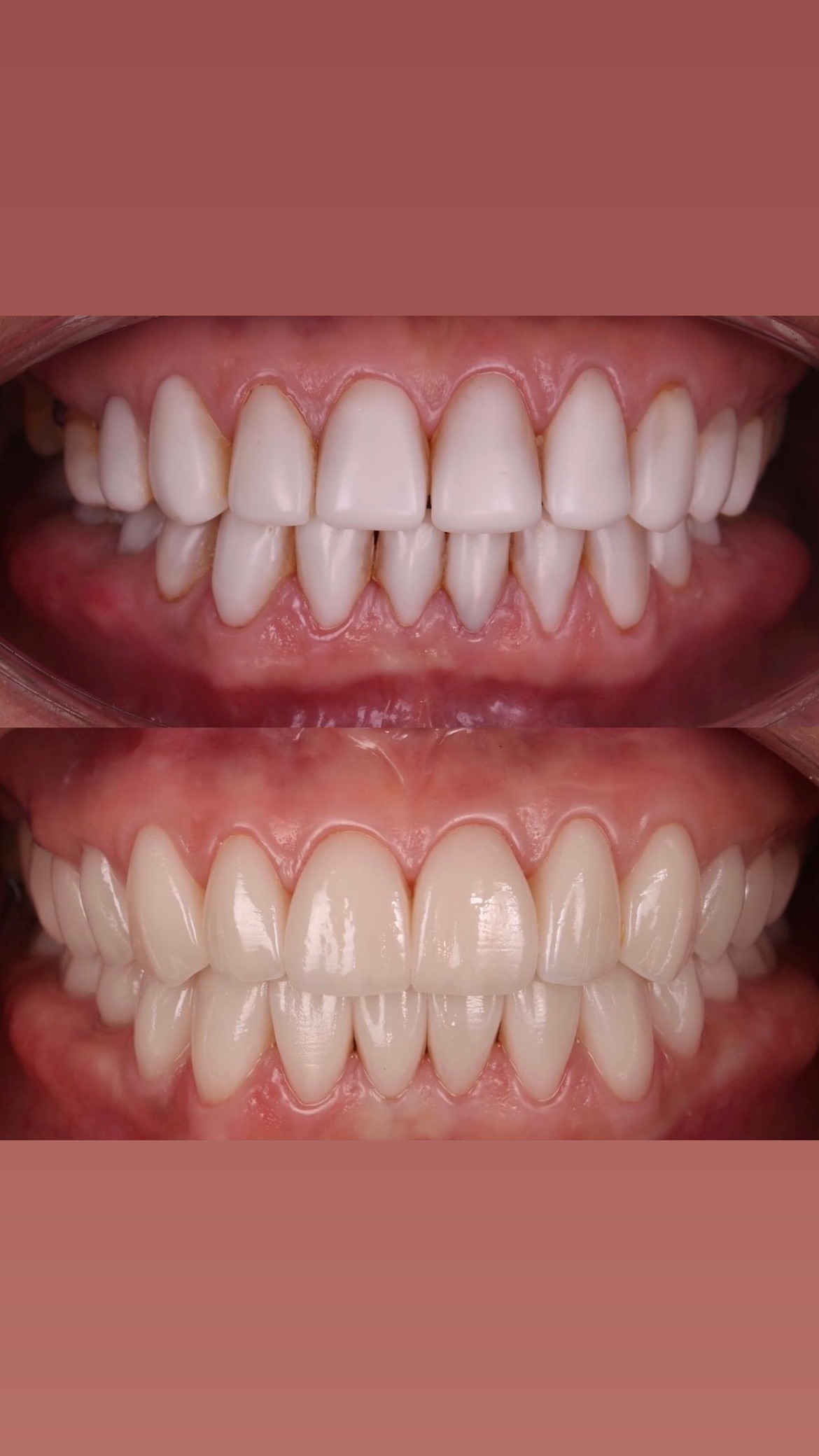 До/После лечения