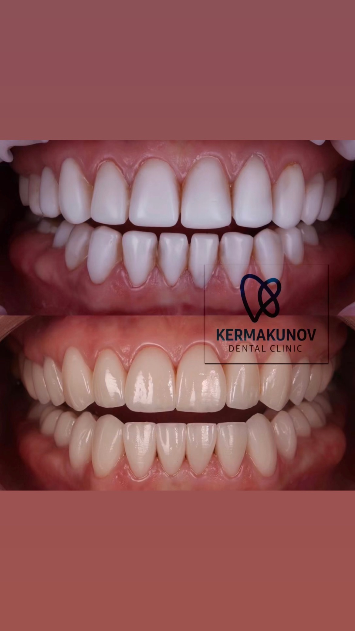 До/После лечения