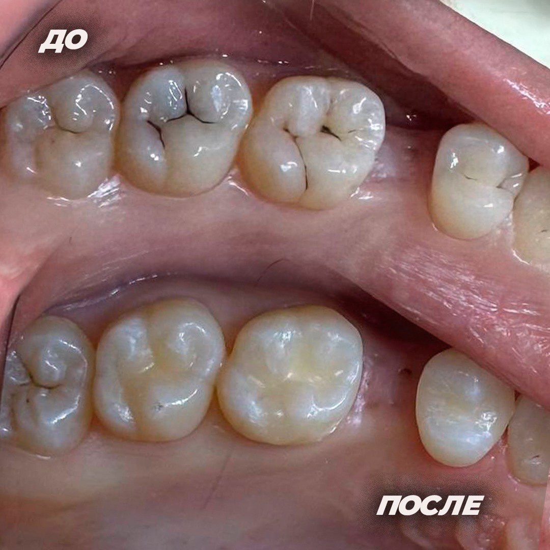Консультация стоматолога